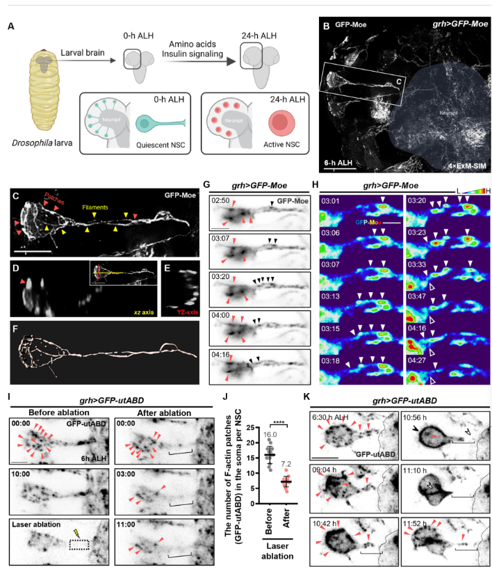 圖2:靜息態神經干細胞再激活過程中的F-肌動蛋白結構和動力學 圖2:靜息態神經干細胞再激活過程中的F-肌動蛋白結構和動力學