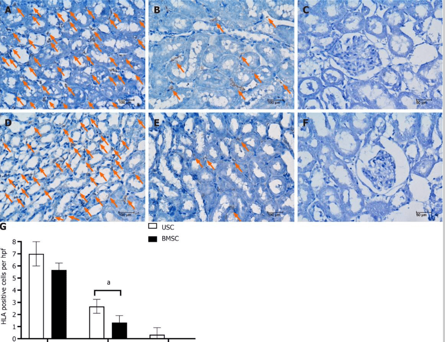 圖5:通過人類白細胞抗原免疫染色檢測急性腎損傷小鼠腎臟內的尿液干細胞或骨髓間充質干細胞 圖5:通過人類白細胞抗原免疫染色檢測急性腎損傷小鼠腎臟內的尿液干細胞或骨髓間充質干細胞