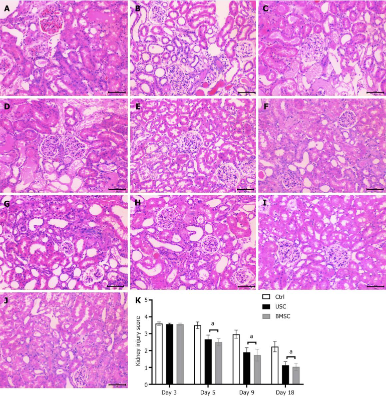 圖4:通過蘇木精和伊紅染色(200 ×)對尿液來源的干細胞治療、骨髓間充質干細胞治療和對照未治療小鼠的急性腎損傷進行組織學檢查。 圖4:通過蘇木精和伊紅染色(200 ×)對尿液來源的干細胞治療、骨髓間充質干細胞治療和對照未治療小鼠的急性腎損傷進行組織學檢查。