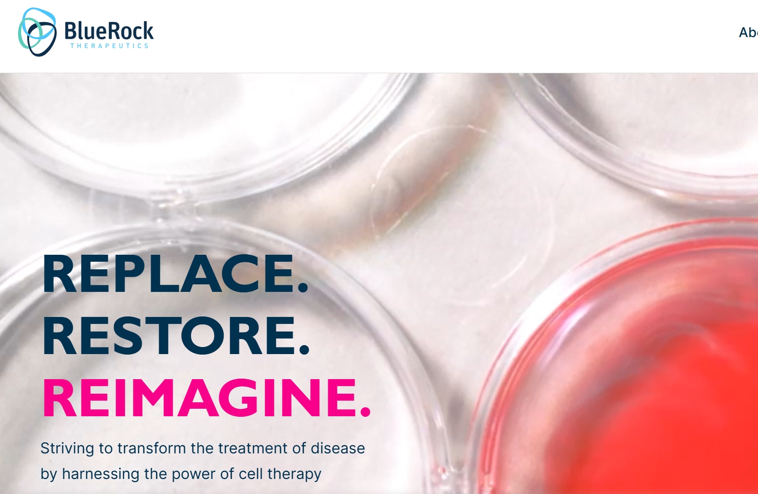 拜耳突破性干細胞治療帕金森病III期臨床試驗啟動，開啟治療新紀(jì)元！