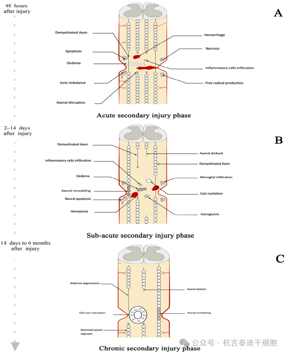 圖2:繼發性病變進展 圖2:繼發性病變進展