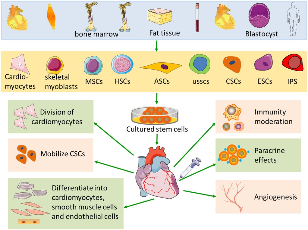 圖1：心肌梗死中的干細(xì)胞療法示意圖。