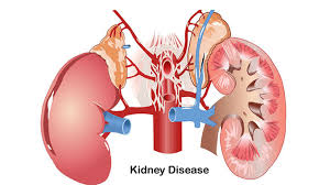 減輕負(fù)擔(dān),延長(zhǎng)生命:干細(xì)胞療法對(duì)降低腎病透析并發(fā)癥的影響評(píng)估 減輕負(fù)擔(dān),延長(zhǎng)生命:干細(xì)胞療法對(duì)降低腎病透析并發(fā)癥的影響評(píng)估