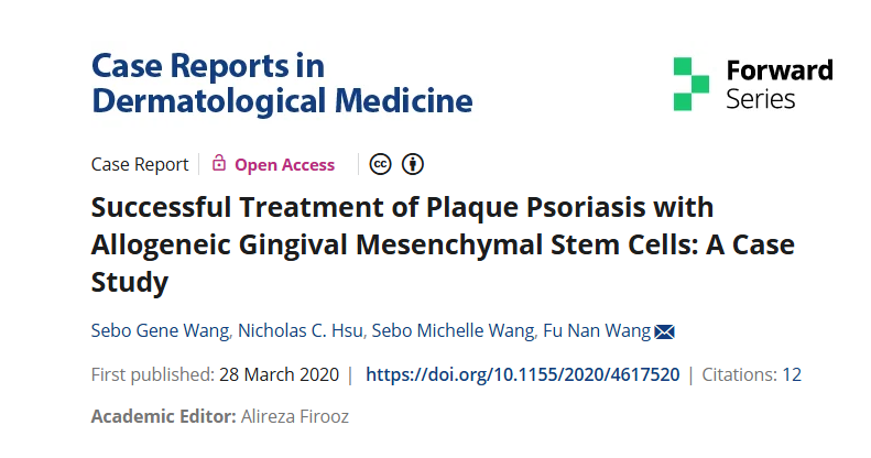 同種異體牙齦間充質(zhì)干細(xì)胞成功治療斑塊性銀屑病：案例研究