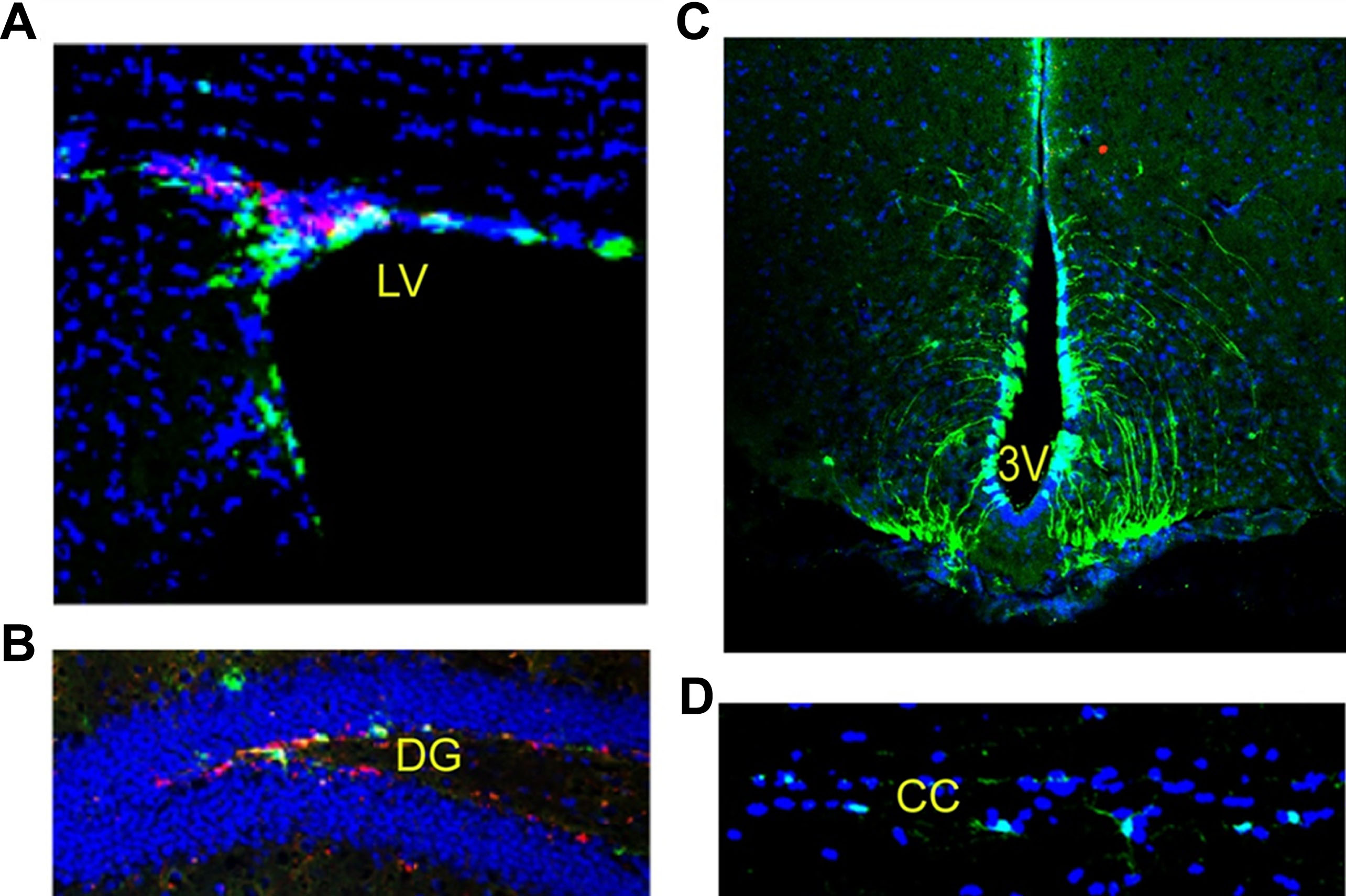 圖2：成年小鼠腦和脊髓中的神經(jīng)干細胞：左腦 (LV)、第三腦室 (DG)、齒狀回 (DG) 和脊髓。