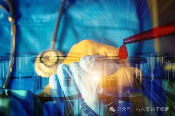 一名RA/MS患者經(jīng)過(guò)CAR-T治療失敗后，經(jīng)過(guò)自體干細(xì)胞移植后，主觀健康狀態(tài)顯著改善！