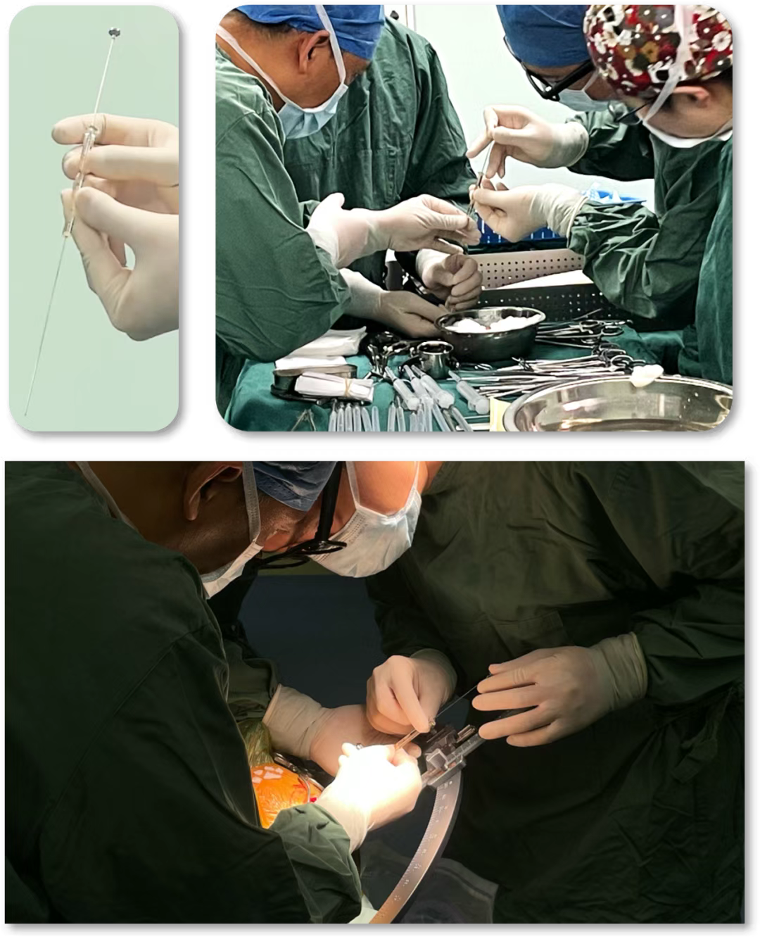 手術流程 手術流程