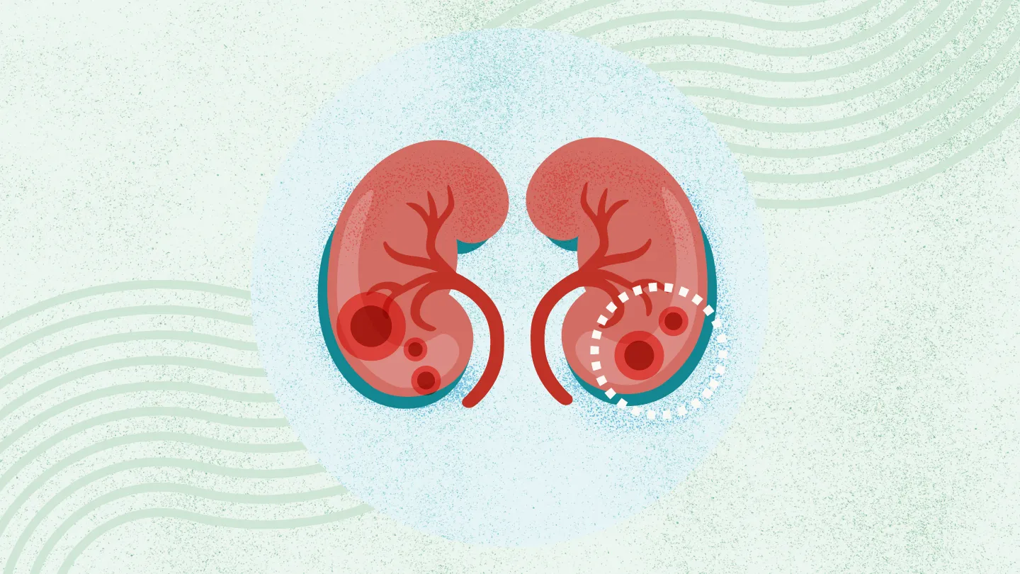 2025年國內(nèi)干細胞治療腎病的醫(yī)院都有哪幾家? 2025年國內(nèi)干細胞治療腎病的醫(yī)院都有哪幾家?