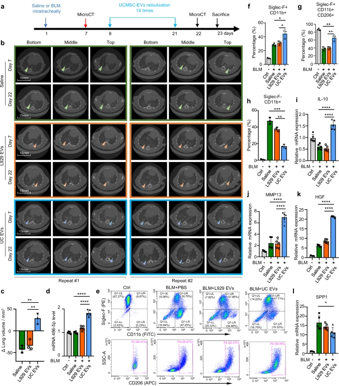 圖3：EVs在肺纖維化治療中的作用。