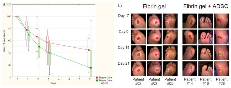 圖1：纖維蛋白凝膠組和AASC組患者治療進展對比。
