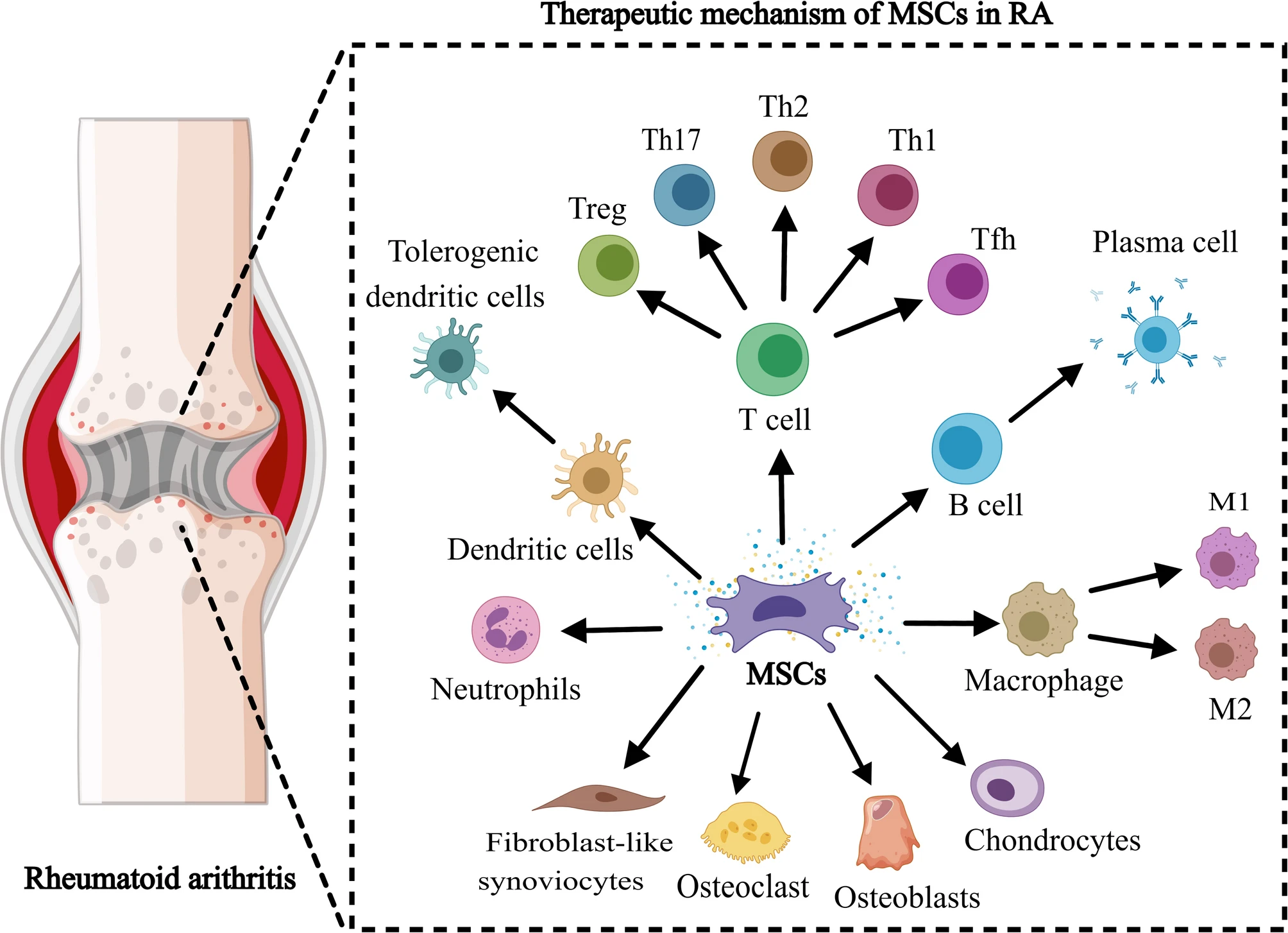 圖3：間充質(zhì)干細(xì)胞在治療類風(fēng)濕性關(guān)節(jié)炎中的機(jī)制。