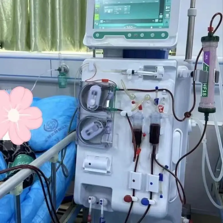 單針交互透析技術 單針交互透析技術