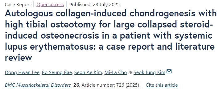 自體膠原誘導軟骨形成聯合脛骨高位截骨術治療系統性紅斑狼瘡患者大面積塌陷性類固醇性骨壞死:病例報告及文獻綜述 自體膠原誘導軟骨形成聯合脛骨高位截骨術治療系統性紅斑狼瘡患者大面積塌陷性類固醇性骨壞死:病例報告及文獻綜述