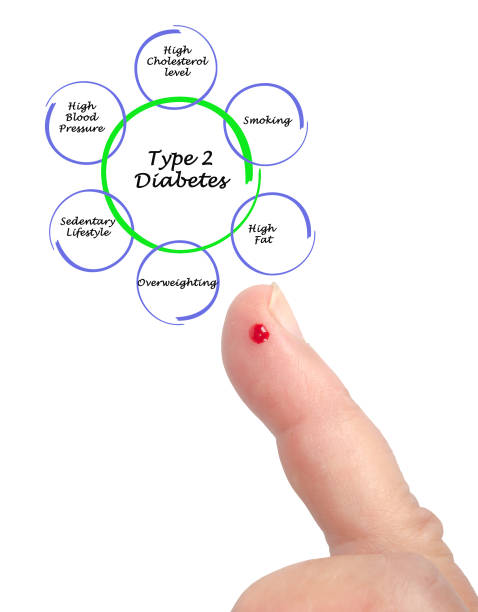 哪些人適合干細胞治療2型糖尿病?專家公布5大評估標準 哪些人適合干細胞治療2型糖尿病?專家公布5大評估標準