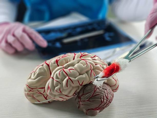 “開關現象”能解決?干細胞為帕金森病治療帶來新希望 “開關現象”能解決?干細胞為帕金森病治療帶來新希望