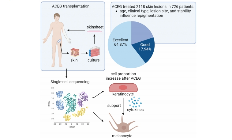 移植過程 移植過程