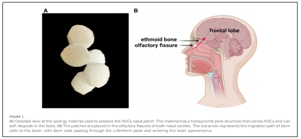 圖1：用于制備NSCs鼻貼片的海綿狀材料的詳細視圖。