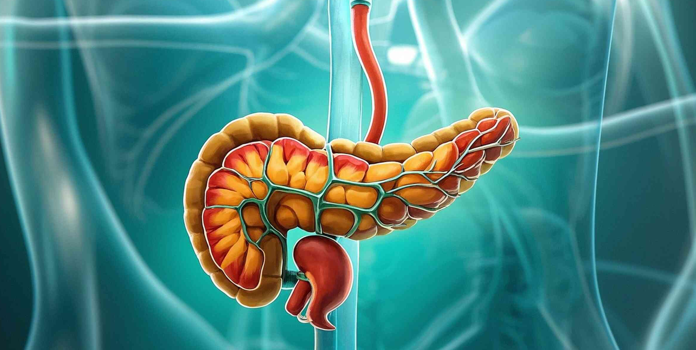 系統(tǒng)性保護！間充質(zhì)干細胞療法為重癥胰腺炎帶來新曙光