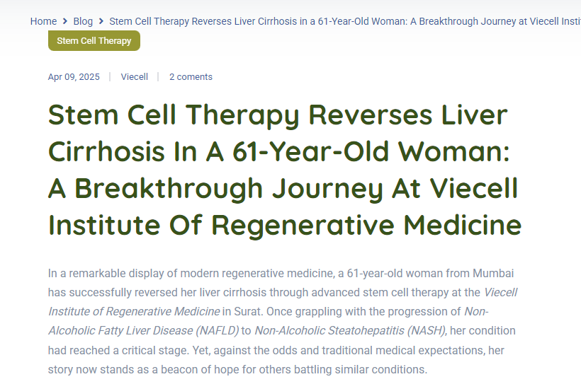 干細胞療法逆轉61歲女性肝硬化:Viecell再生醫學研究所的突破之旅 干細胞療法逆轉61歲女性肝硬化:Viecell再生醫學研究所的突破之旅