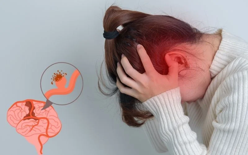 神經干細胞移植治療腦出血：機制、療效與轉化前景