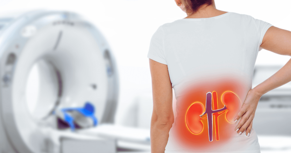 2025年1-12月:干細胞治療狼瘡性腎炎最新臨床進展匯總 2025年1-12月:干細胞治療狼瘡性腎炎最新臨床進展匯總