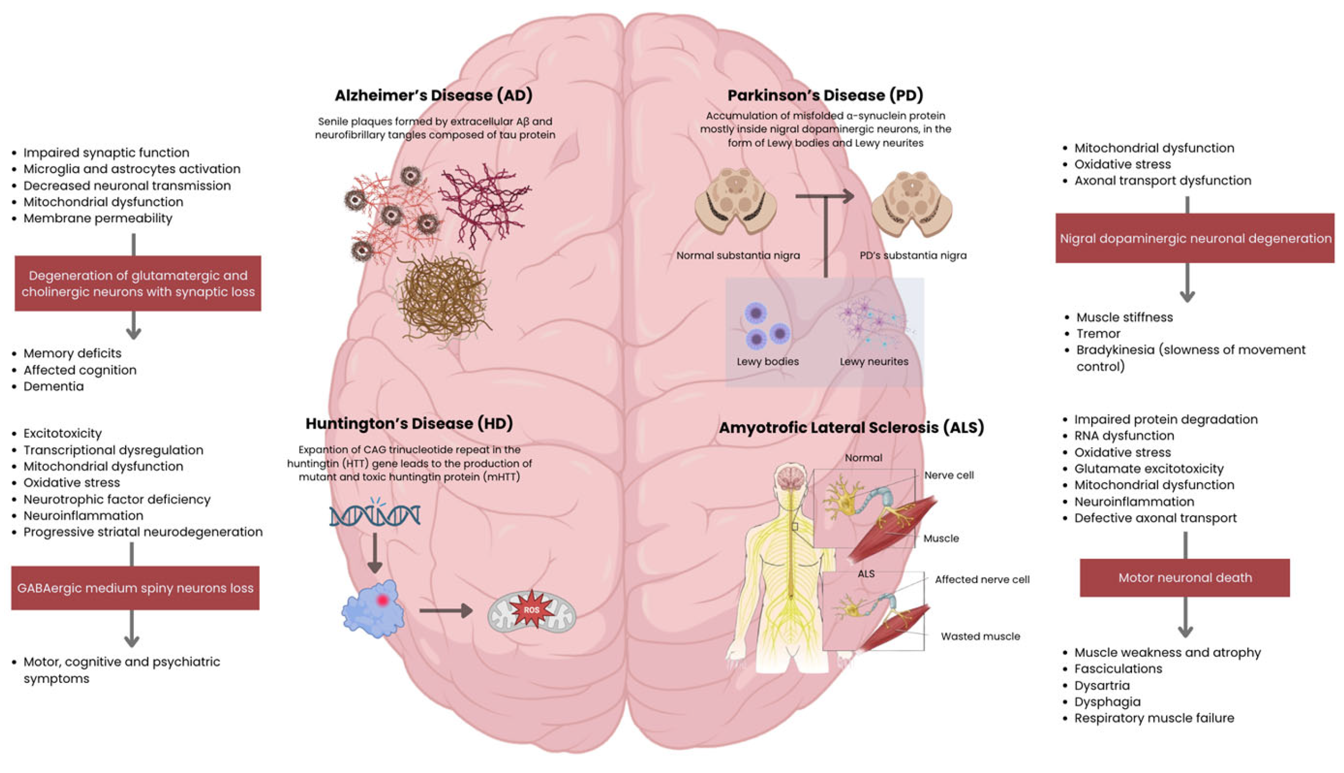 圖2:主要神經退行性疾病的病理生理機制和臨床特征。側邊欄概述了從細胞功能障礙到特定神經元丟失以及隨后的臨床表現的進展過程。 圖2:主要神經退行性疾病的病理生理機制和臨床特征。側邊欄概述了從細胞功能障礙到特定神經元丟失以及隨后的臨床表現的進展過程。