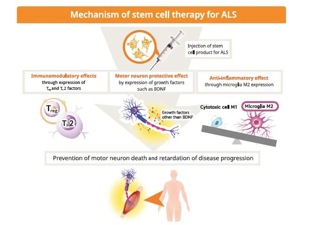 NeuroNata-R是一種在韓國獲批用于治療肌萎縮側(cè)索硬化癥 (ALS) 的干細(xì)胞療法。 NeuroNata-R是一種在韓國獲批用于治療肌萎縮側(cè)索硬化癥 (ALS) 的干細(xì)胞療法。