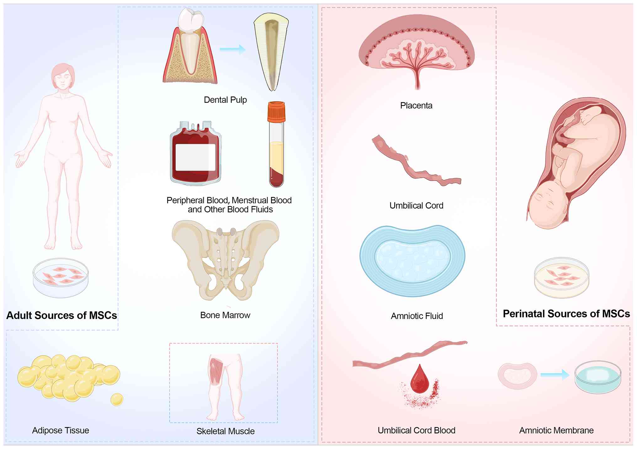 圖2：間充質干細胞的來源。成人間充質干細胞可來源于骨髓、脂肪組織、外周血、骨骼肌和牙髓。圍產期間充質干細胞通常取自胎盤、臍帶、臍帶血、羊水和羊膜。
