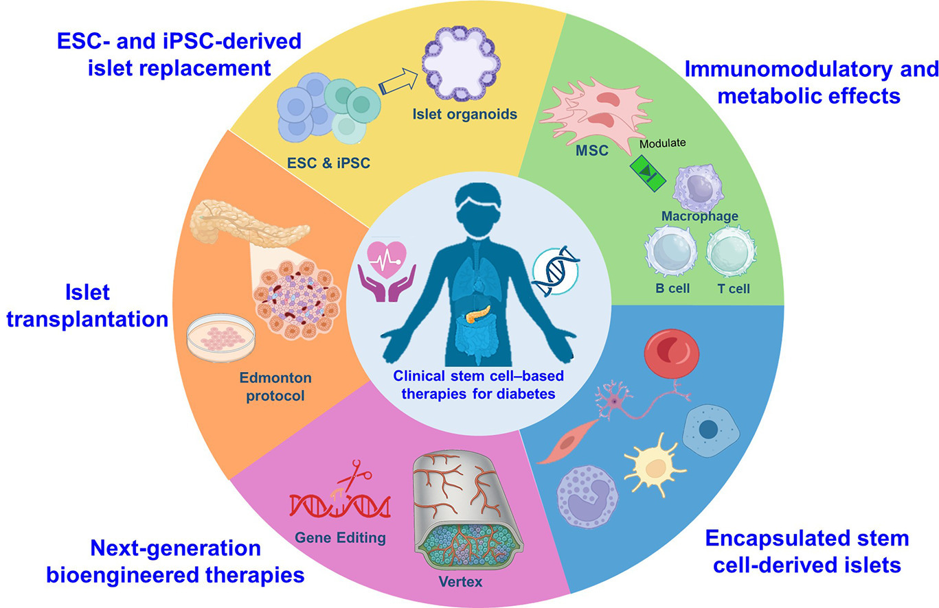 干細(xì)胞療法重塑糖尿病治療格局——主要臨床試驗(yàn)概述與未來(lái)展望 干細(xì)胞療法重塑糖尿病治療格局——主要臨床試驗(yàn)概述與未來(lái)展望