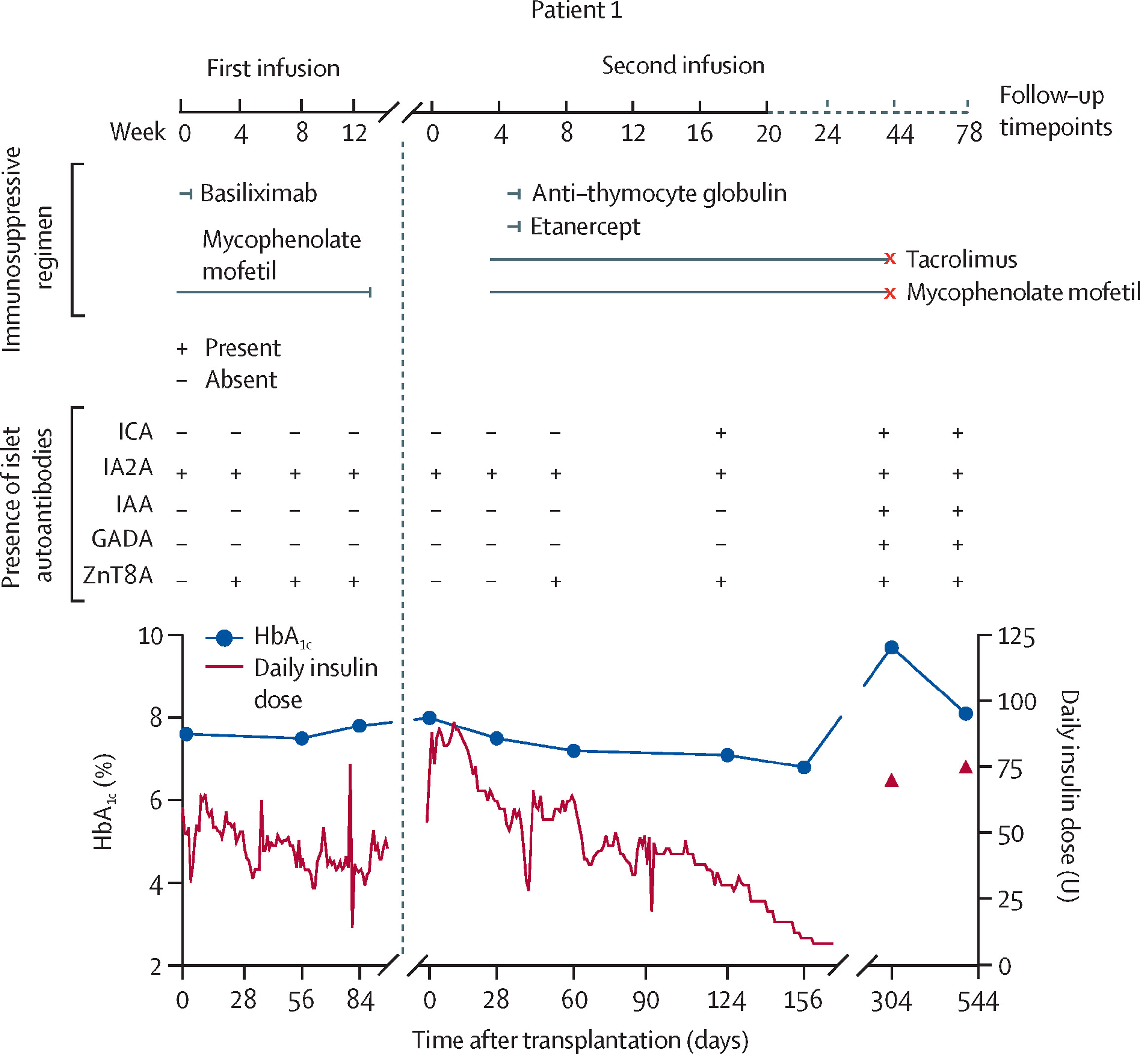 圖1:自體和異體E-胰島移植聯合不同免疫抑制方案治療患者1的療效 圖1:自體和異體E-胰島移植聯合不同免疫抑制方案治療患者1的療效